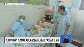 VIDEO: Kondisi Bayi Kembar Aqila-Azila Membaik Pascaoperasi