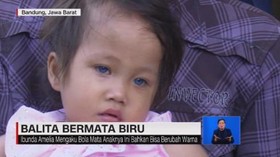 VIDEO: Heboh Balita 2,5 Tahun Berbola Mata Biru