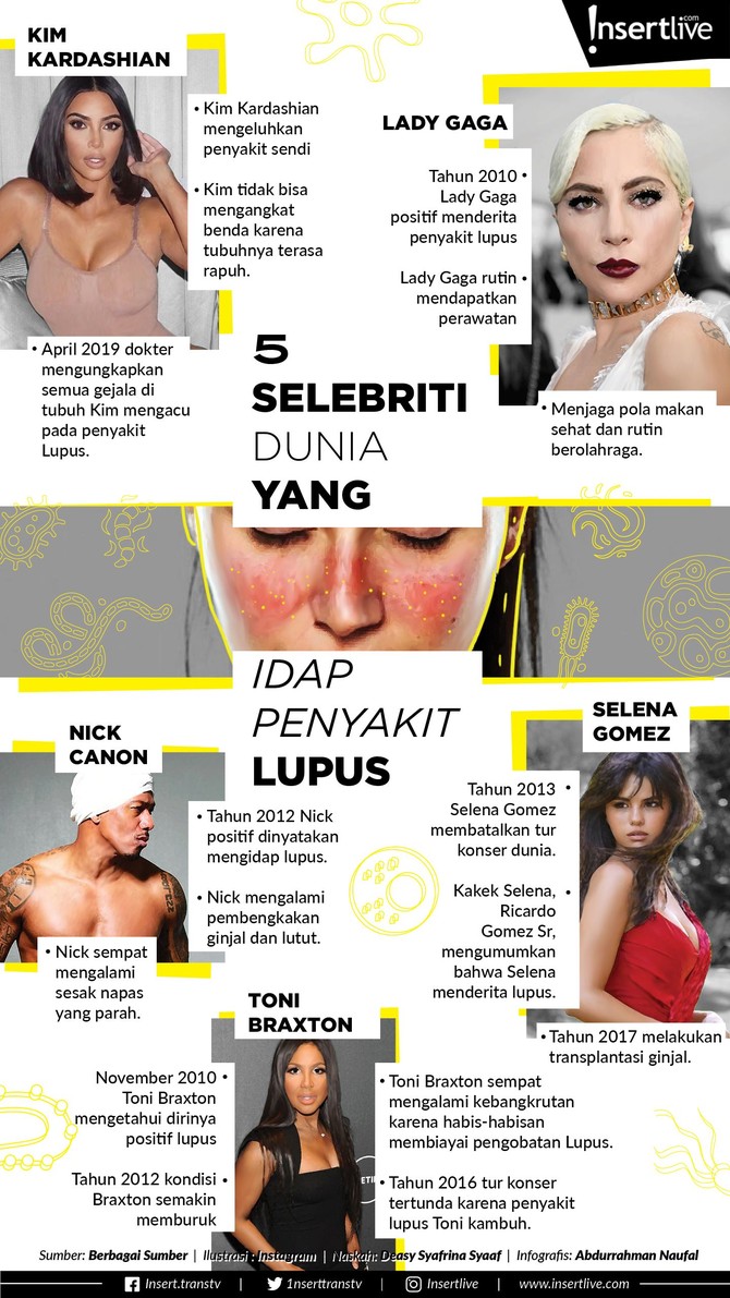 Infografis: 5 Selebriti Dunia yang Idap Penyakit Lupus Penyakit lupus yang menyerang sistem autoimun tubuh terbilang cukup menakutkan. Beberapa selebriti dunia yang positif mengidap lupus: