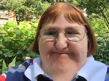 Curhat Pilu Wanita Disabilitas, Tak Sangka Wajahnya Dipakai Menakut-nakuti Anak