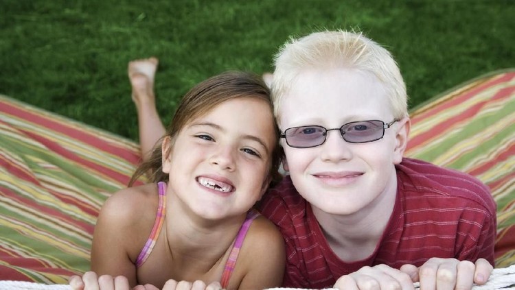 Albino ini merupakan kelainan genetik yang menyebabkan seseorang memiliki rambut dan kulit berwarna terang.