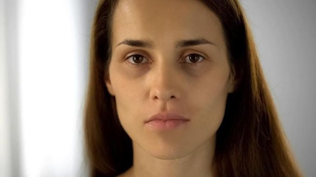 Tired woman with black circles under eyes looking at camera, lack of sleep