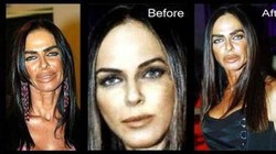 Wajah Aneh Selebriti Usai Operasi Plastik