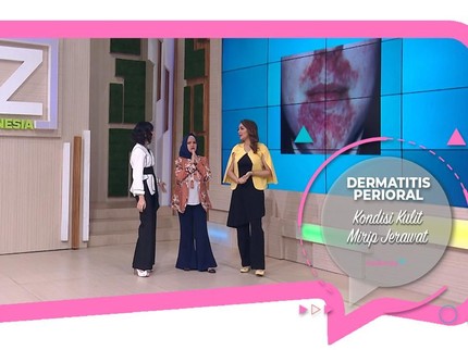Dermatitis Perioral, Kondisi Kulit Mirip Jerawat