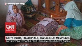 VIDEO: Satya Putra, Bocah Penderita Obesitas Meninggal