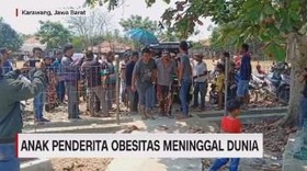VIDEO: Anak Penderita Obesitas Meninggal Dunia