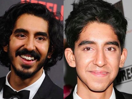Transformasi Dev Patel 'Slumdog Millionaire', Aih Makin Ganteng!