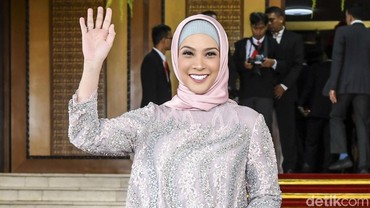Rachel Maryam Alami Pendarahan Usai Melahirkan, Ini Kata Dokter