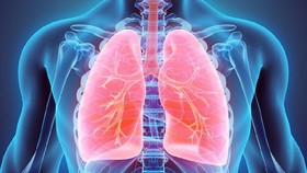 Hari Pneumonia Sedunia, Penyakit Paru Mematikan Intai Balita