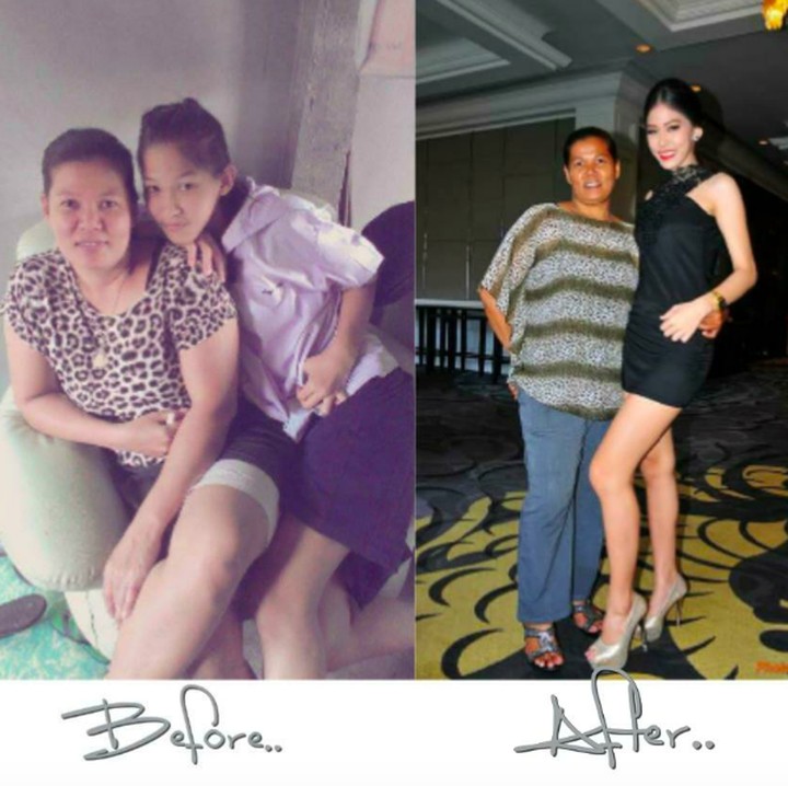 <p>Before-after Khanittha dan sang bunda. Tetap sayang dan bahagia ya ibu dan anak ini, Bun? (Foto: Facebook/Khanittha Phasaeng)  </p>