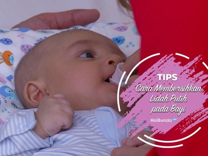Cara Membersihkan Lidah Putih pada Bayi