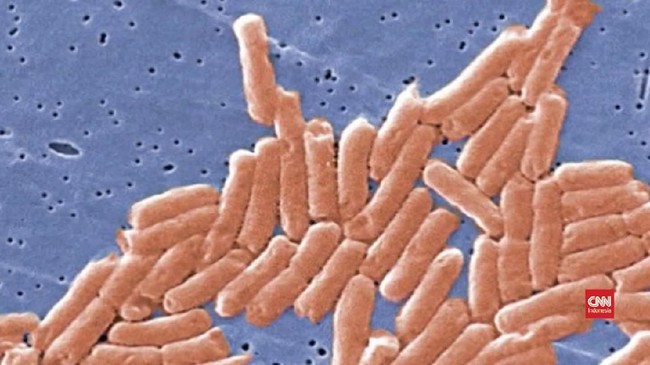 Tiga orang meninggal dunia akibat terinfeksi bakteri "pemakan daging" yang langka. Peristiwa ini terjadi di Amerika Serikat belum lama ini.