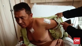 Cerita Kapolsek Menes Kena 5 Tusukan saat Lindungi Wiranto