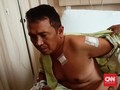 Cerita Kapolsek Menes Kena 5 Tusukan saat Lindungi Wiranto