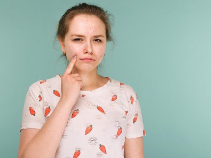 Kulit Bunda Berjerawat? Cobain Yuk 8 Skincare Korea yang Ampuh Mengatasinya