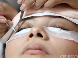 Kisah Pengantin Dibawa ke RS di Hari Pernikahan karena Bulu Mata Palsu