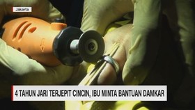 VIDEO: 4 Tahun Jari Terjepit Cincin, Ibu Minta Bantuan Damkar