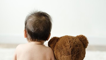 GEJALA SINDROM PROGERIA YANG LANGKA