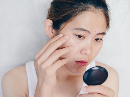 Jangan Asal Pencet Jerawat, yang Benar Ini Saran Dokter