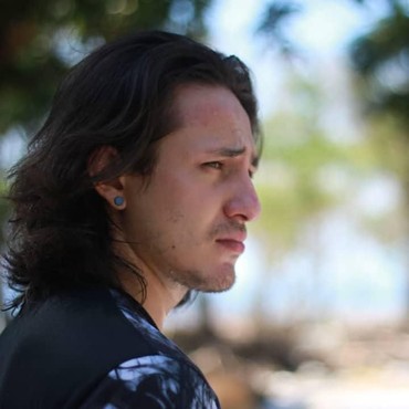 Alami Kecelakaan Mobil di Tol JORR, Dylan Carr Terluka Parah