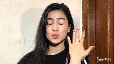 img-title Dilamar Kekasih Saat Ulang Tahun, Felicya Angelista: Speechless