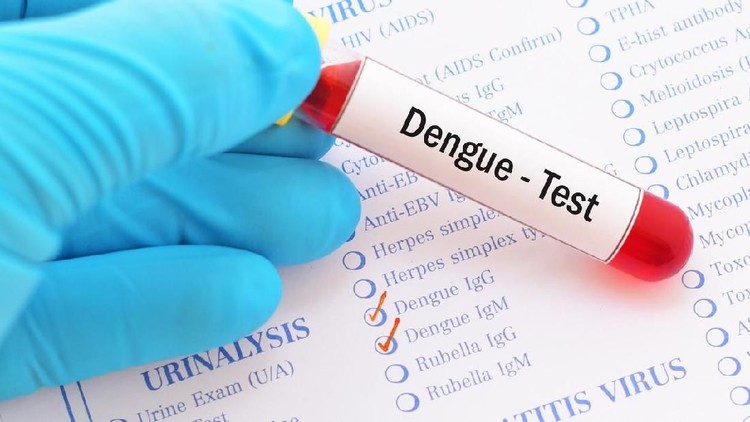 Selama ini, kita tahu virus demam berdarah menular lewat nyamuk. Tapi, baru-baru ini ada seorang pria yang tertular penyakit ini setelah melakukan seks.