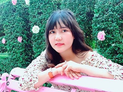 Selain Via Vallen, Wajah 5 Artis Ini Juga Aneh Akibat Perawatan