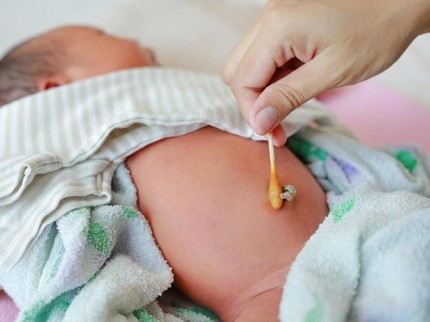 Cara Tepat Merawat Tali Pusat Bayi Baru Lahir
