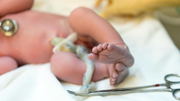 Photo of a new born baby where the focus is on feet and toes. The umbilical cord is there with surgical scissors attached. The face of the baby is not in the photograph. Body color is pink and feet are slightly purple.