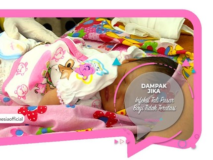 Dampak Jika Infeksi Tali Pusar Bayi Tidak Teratasi
