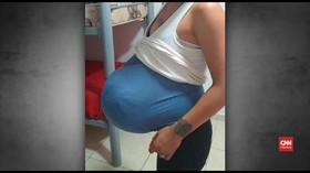 VIDEO: Sembunyikan Ganja, Seorang Perempuan Pura-pura Hamil