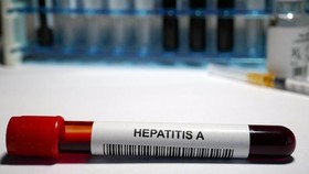 Waspada Hepatitis Misterius, Bayi di Surabaya Diisolasi Khusus