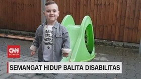 VIDEO: Semangat Hidup Taylor, Balita Disabilitas