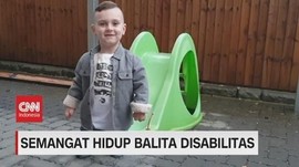 VIDEO: Semangat Hidup Taylor, Balita Disabilitas