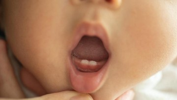 APA PENYEBAB BAYI TERLAMBAT TUMBUH GIGI?