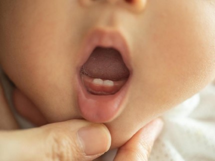 Tips Merawat Gigi Bayi Usia 6 Bulan, Bunda Perlu Tahu