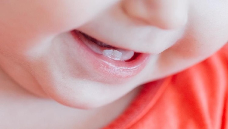 Two baby teeth of a one year old baby in a smile