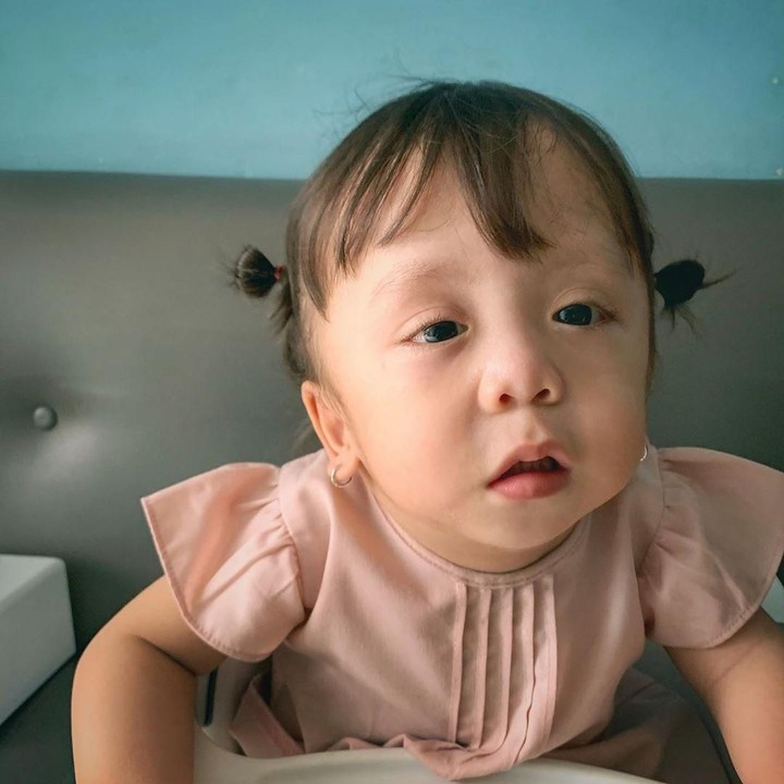 <p>Di usia 11 bulan, Ziona didiagnosis campomelic dysplasia (CMD), yakni suatu kondisi langka yang bisa mengancam jiwa. (Foto: Instagram @joannaalexandra)</p>