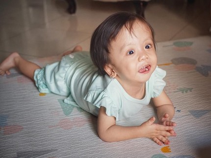 Anak Joanna Alexandra Idap Penyakit Langka, Ini Potret Perkembangannya