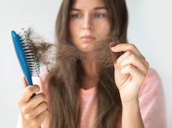 7 Makanan Penyebab Rambut Rontok Parah