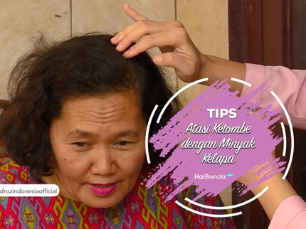 Tips Atasi Ketombe dengan Minyak Kelapa