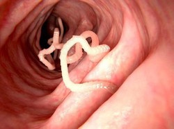 10 Obat Cacing Dewasa Alami dan Kimia yang Bagus, Ampuh dan Dosisnya