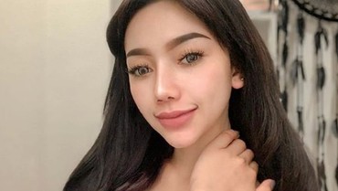 Begini Kronologi Polisi Ribut dengan Model Panas Messya Iskandar
