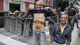 FOTO: Potret Kelaparan akibat Krisis Venezuela Krisis Venezuela yang terjadi sejak Pemilu 2018 berbuntut panjang dan menyisakan krisis ekonomi bagi warganya.