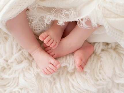 Kisah Unik Bayi Kembar yang Lahir Berbeda Warna Kulit, Kok Bisa?
