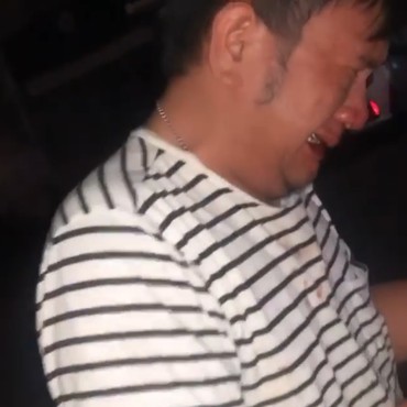 Berdarah-darah di Wajah, Asisten DJ Nathalie Holscher Bonyok Dipukuli