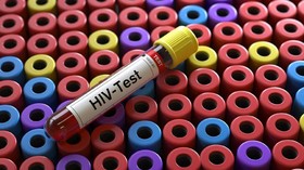 Fakta Varian Ganas Virus HIV di Belanda