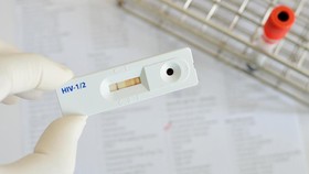 Virus Corona Potensi Serang Antibodi, Mirip HIV