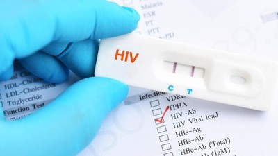 HIV Menular dari Tusuk Gigi, Mitos atau Fakta?