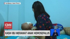VIDEO: Kasih Ibu Merawat Anak Hidrosefalus